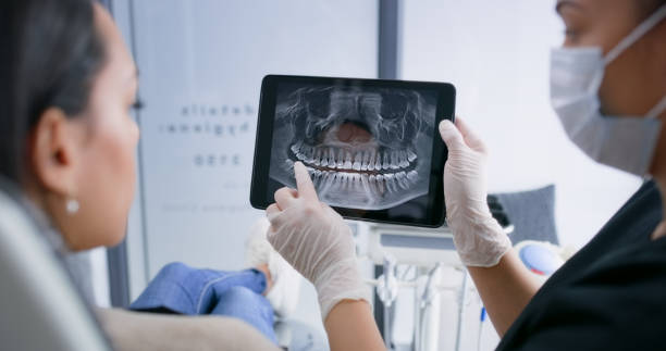 Licensed Tooth Extraction service in Sabine Parish County, LA - Smile Center Dentistry